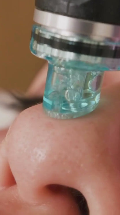 Pore Cleaning Device